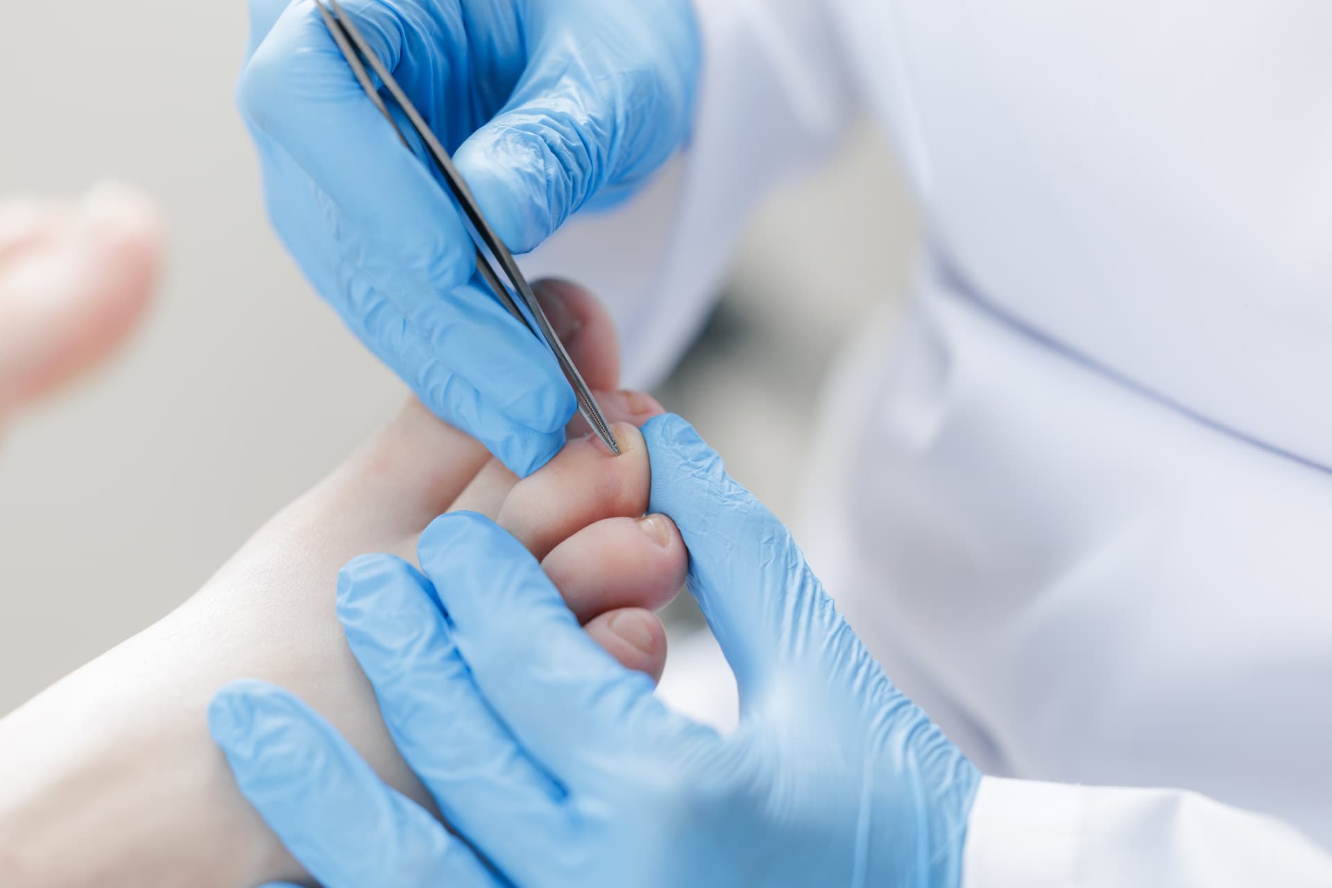 Follow-Up Treatment provided at home by a qualified foot health practitioner in Hertfordshire